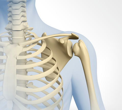 Traitement d’une calcification de l’épaule